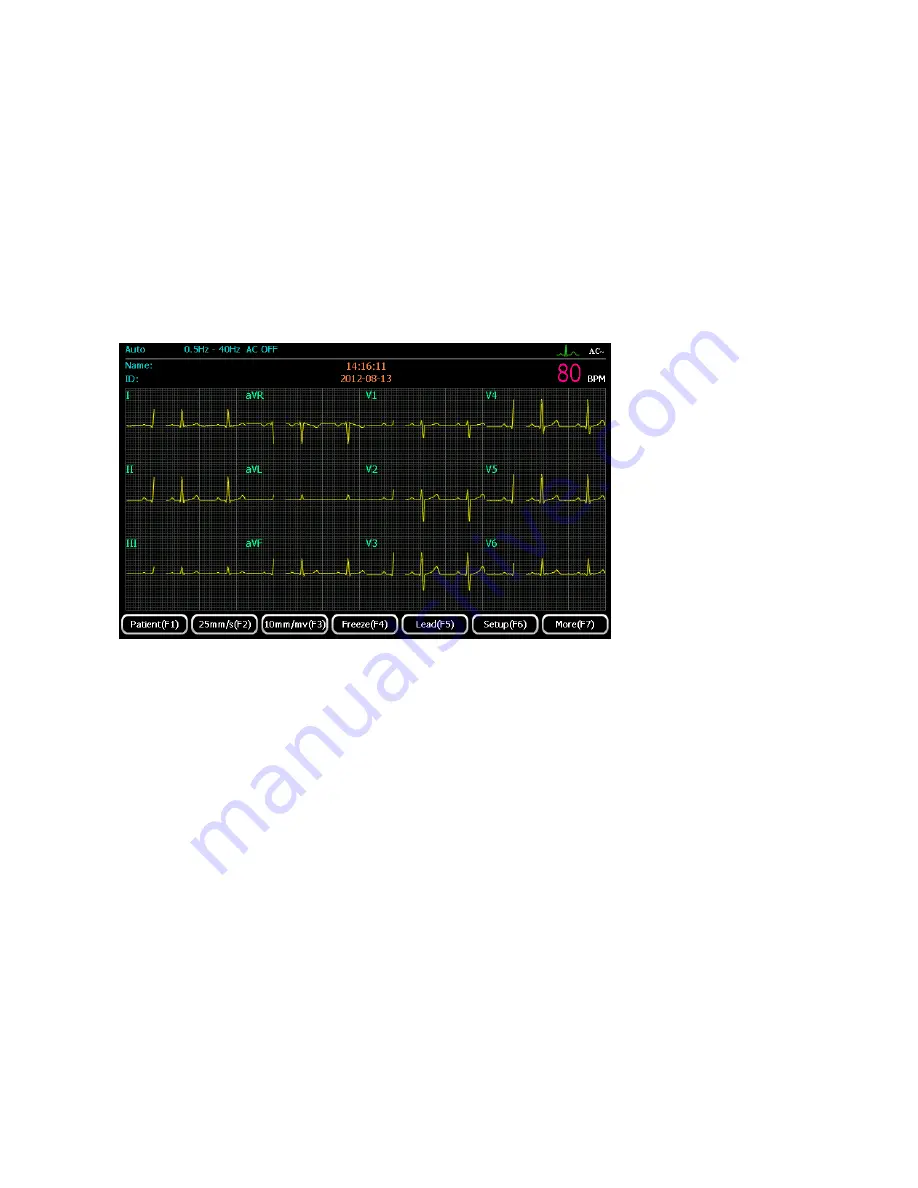 ECGMAC EM-1201 Скачать руководство пользователя страница 38