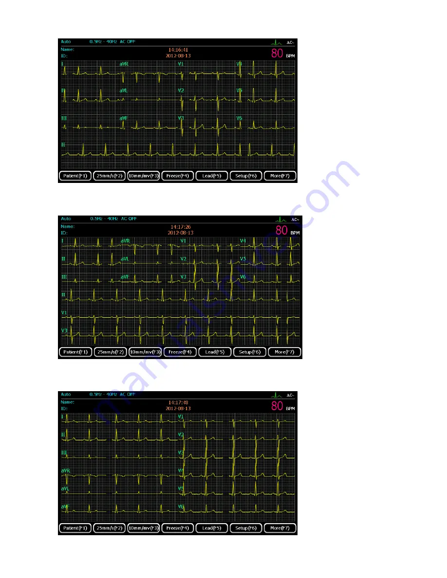 ECGMAC EM-1201 Manual Download Page 39