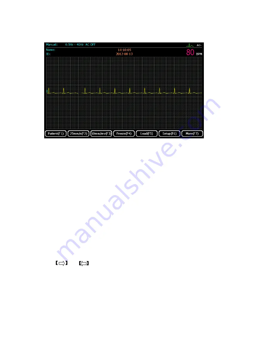 ECGMAC EM-1203 Manual Download Page 34