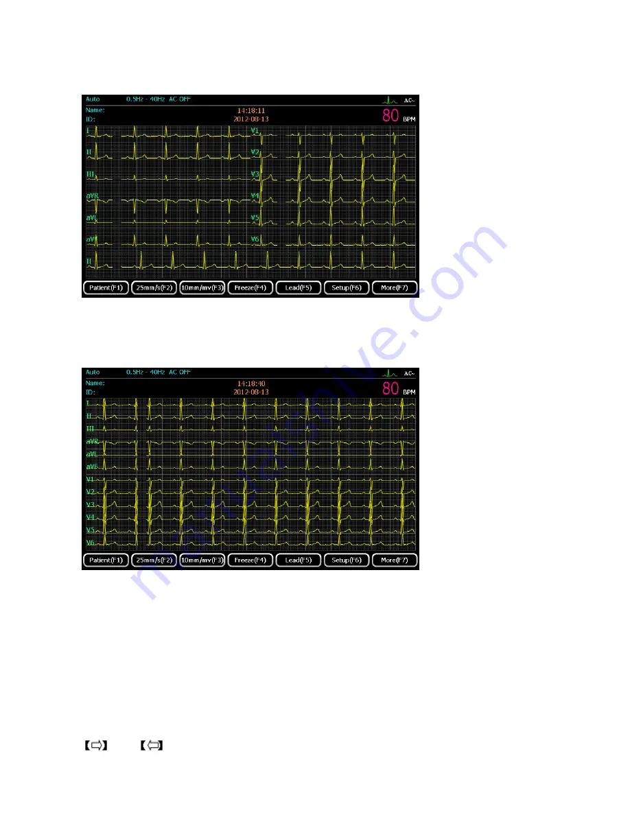 ECGMAC EM-1203 Manual Download Page 40