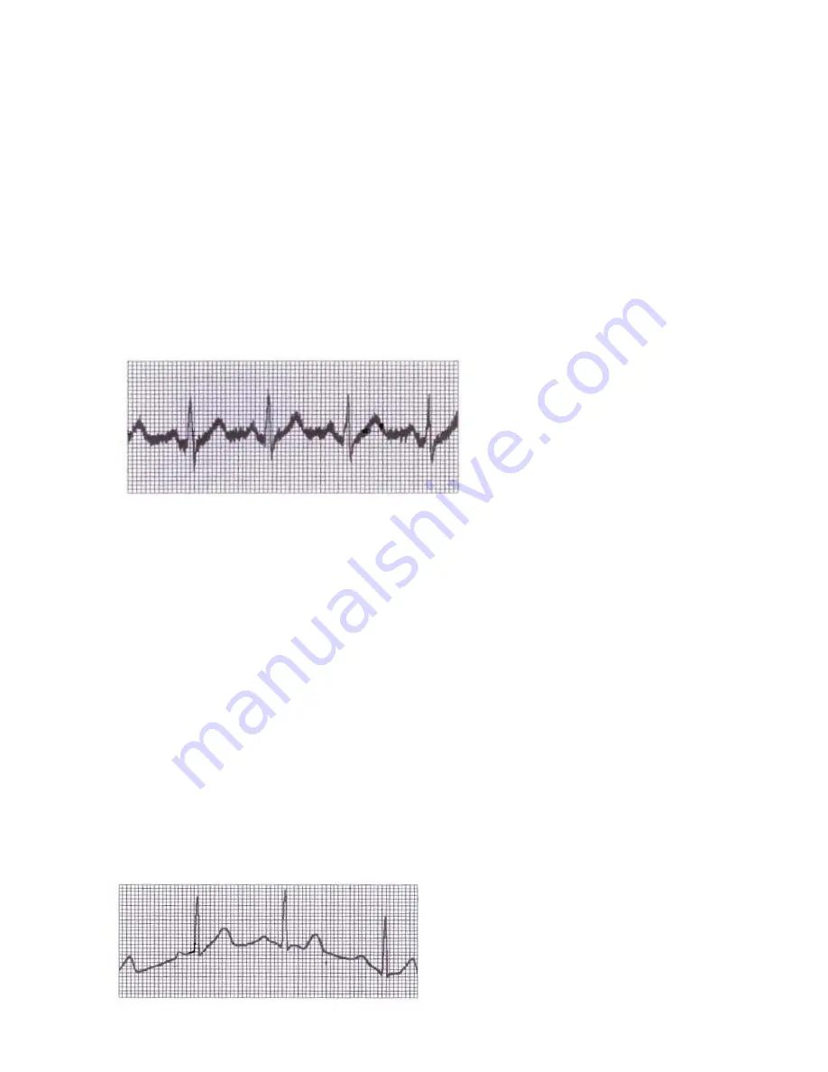 ECGMAC EM-1203 Manual Download Page 53