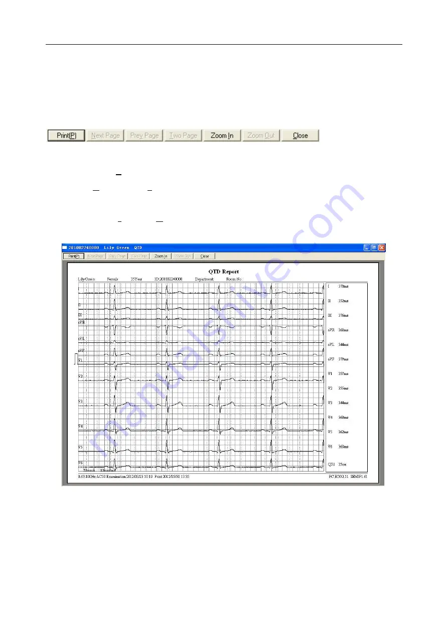 EDAN SE-101 User Manual Download Page 74