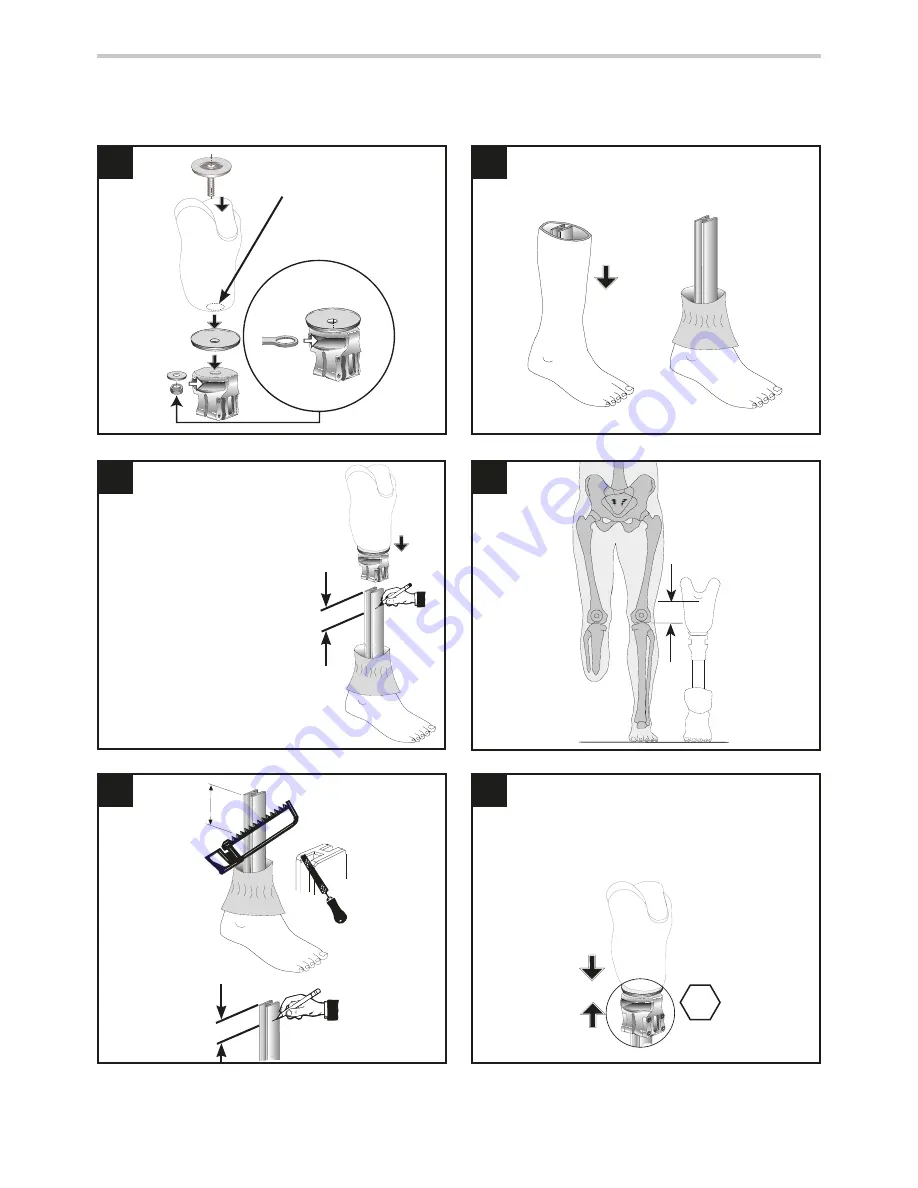 endolite AqualimbTT Instructions For Use Manual Download Page 30