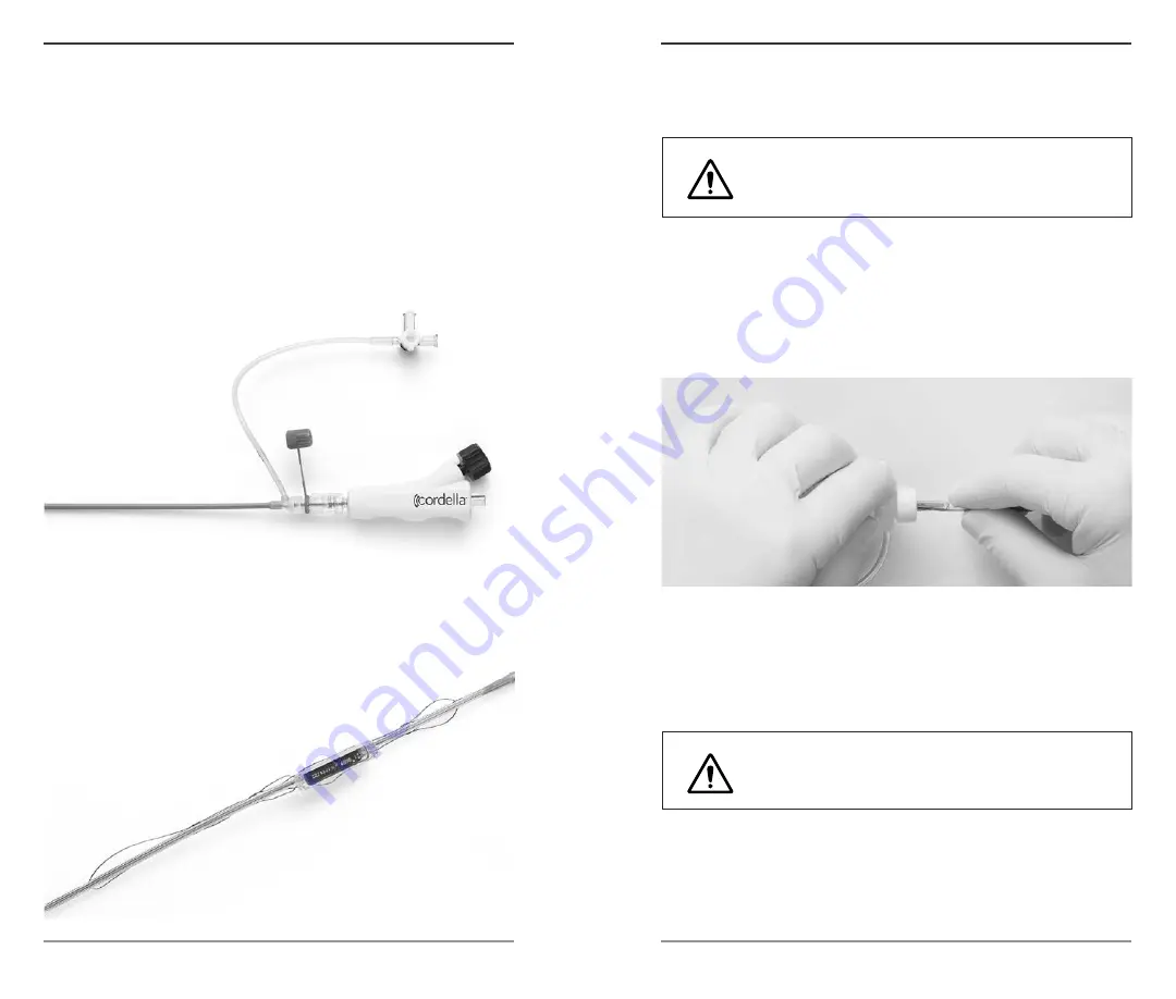 Endotronix Cordella Instructions For Use Manual Download Page 14