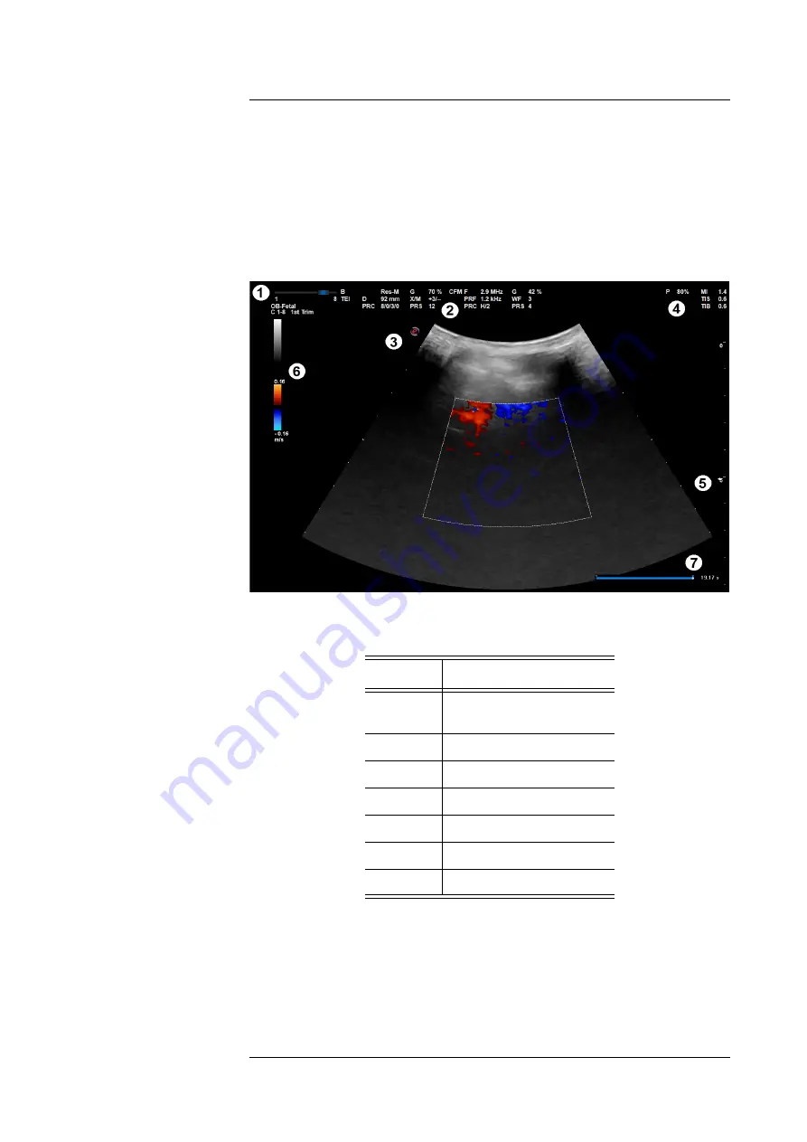 Esaote MyLabX5VET Getting Started Download Page 68