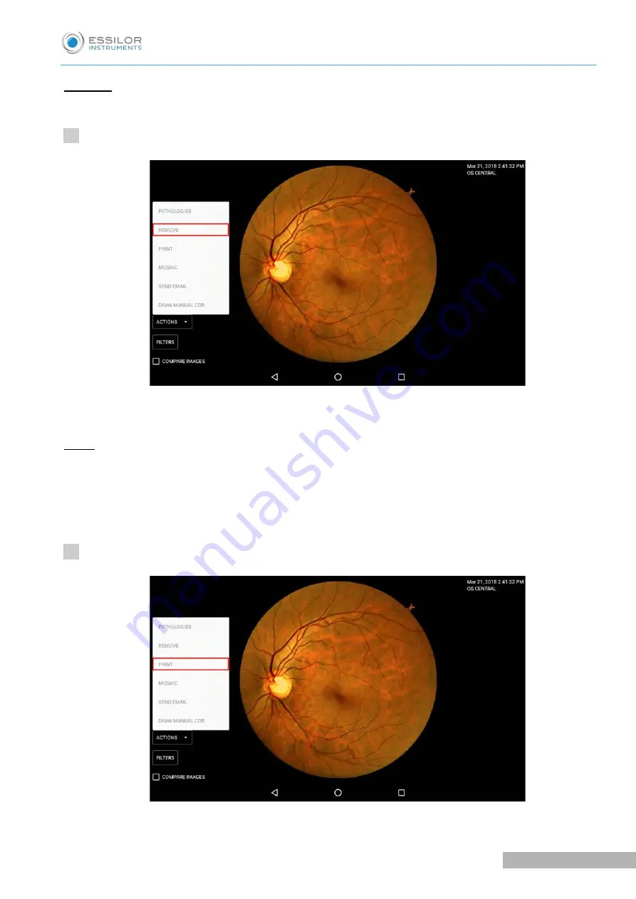 Essilor Instruments Retina 800 Скачать руководство пользователя страница 38