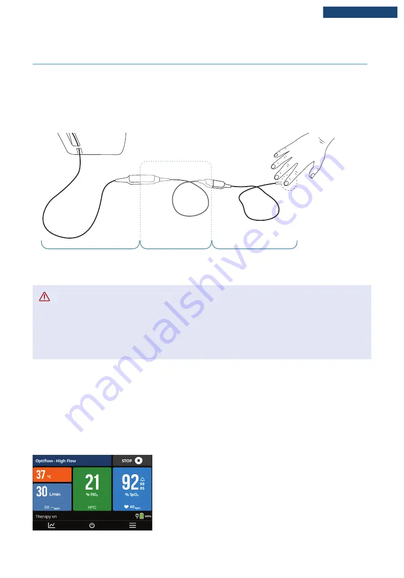 F&P Airvo 3 User Manual Download Page 40