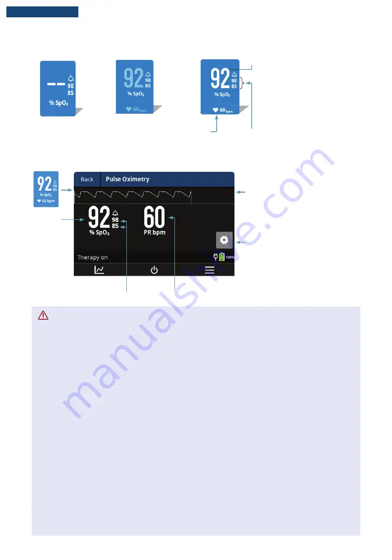 F&P Airvo 3 User Manual Download Page 41