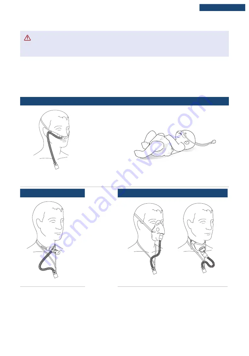 F&P Airvo 3 User Manual Download Page 68