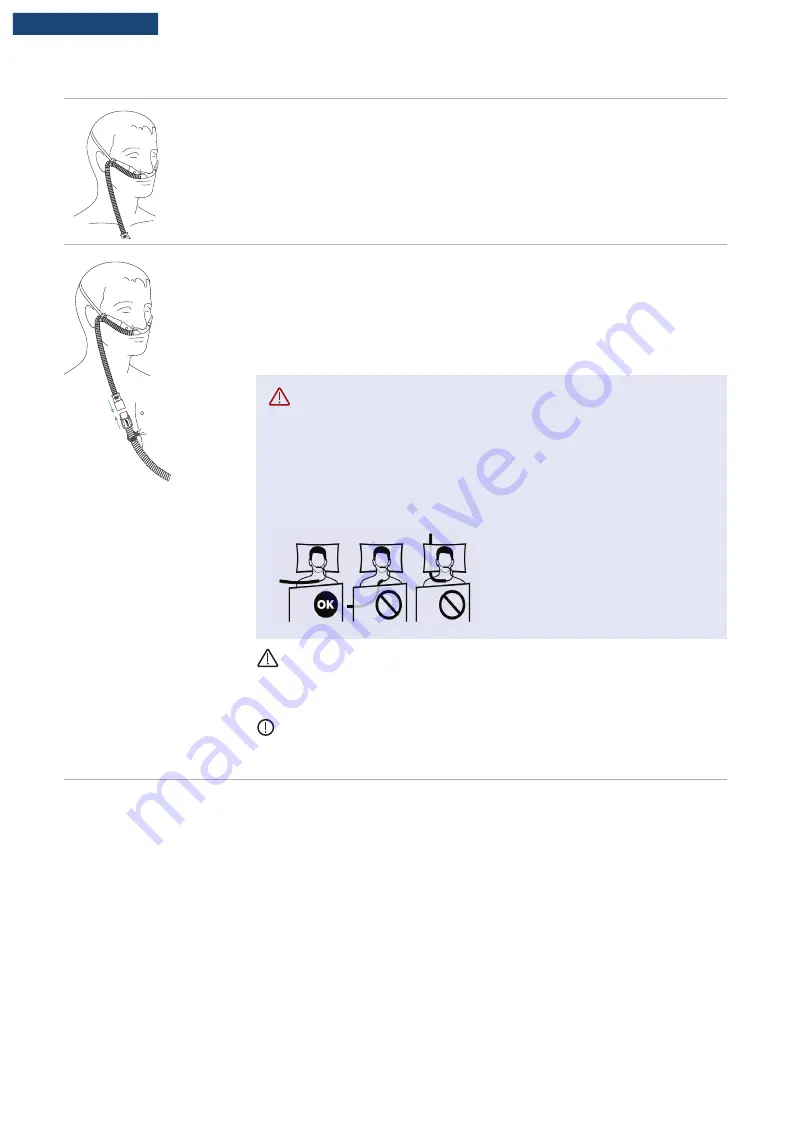 F&P Airvo 3 User Manual Download Page 77