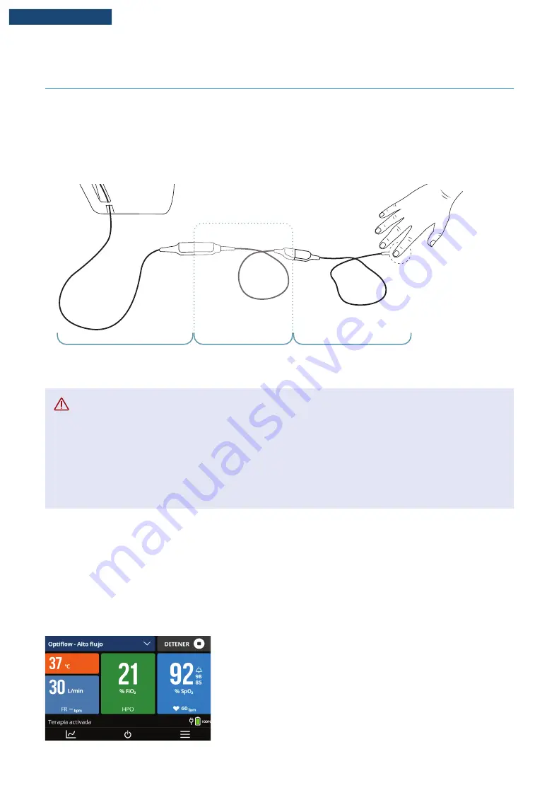 F&P Airvo 3 User Manual Download Page 93