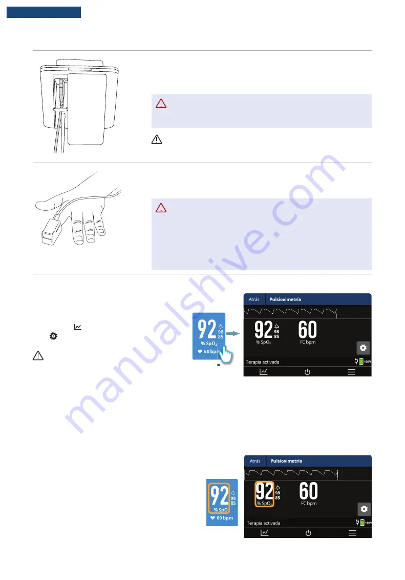 F&P Airvo 3 Скачать руководство пользователя страница 95