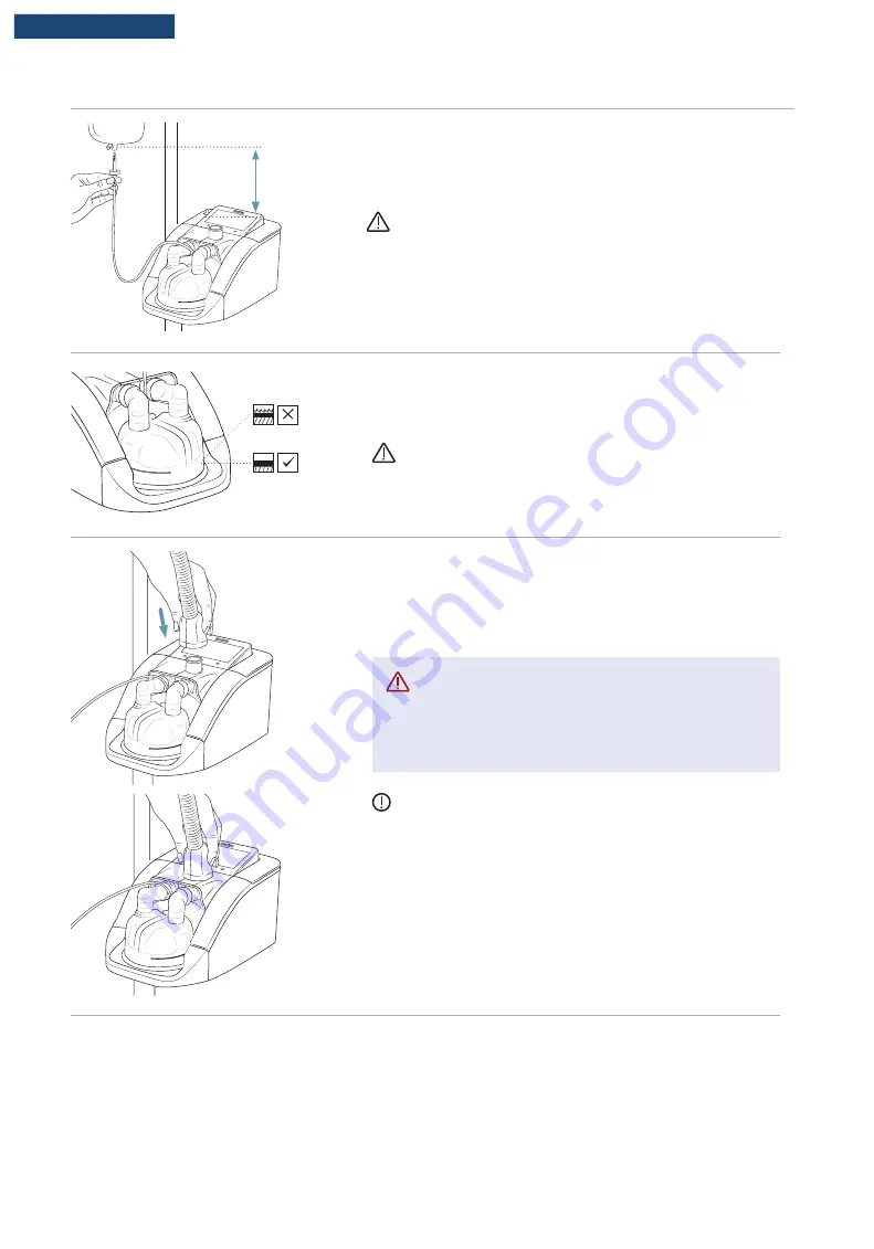 F&P Airvo 3 User Manual Download Page 123