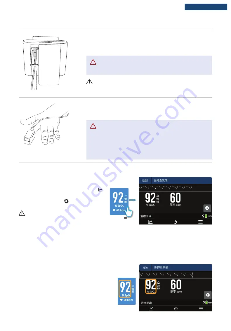 F&P Airvo 3 User Manual Download Page 148