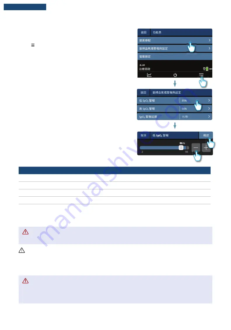 F&P Airvo 3 User Manual Download Page 151