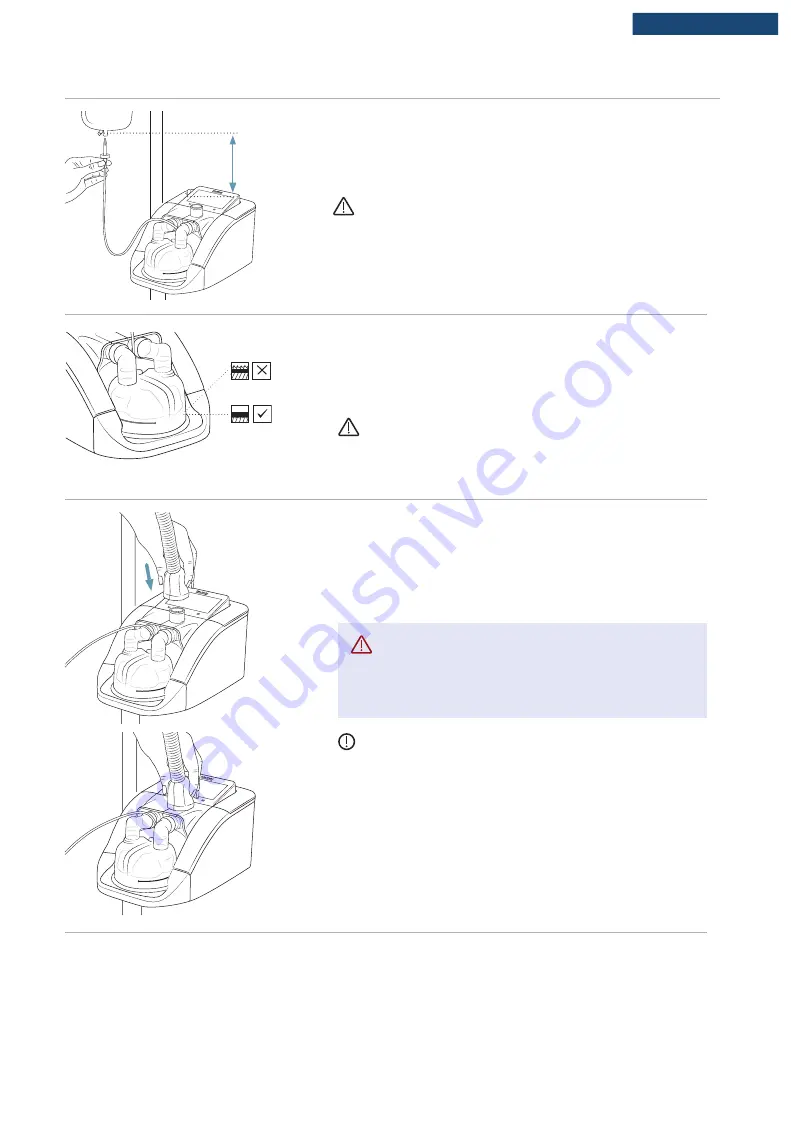 F&P Airvo 3 User Manual Download Page 176