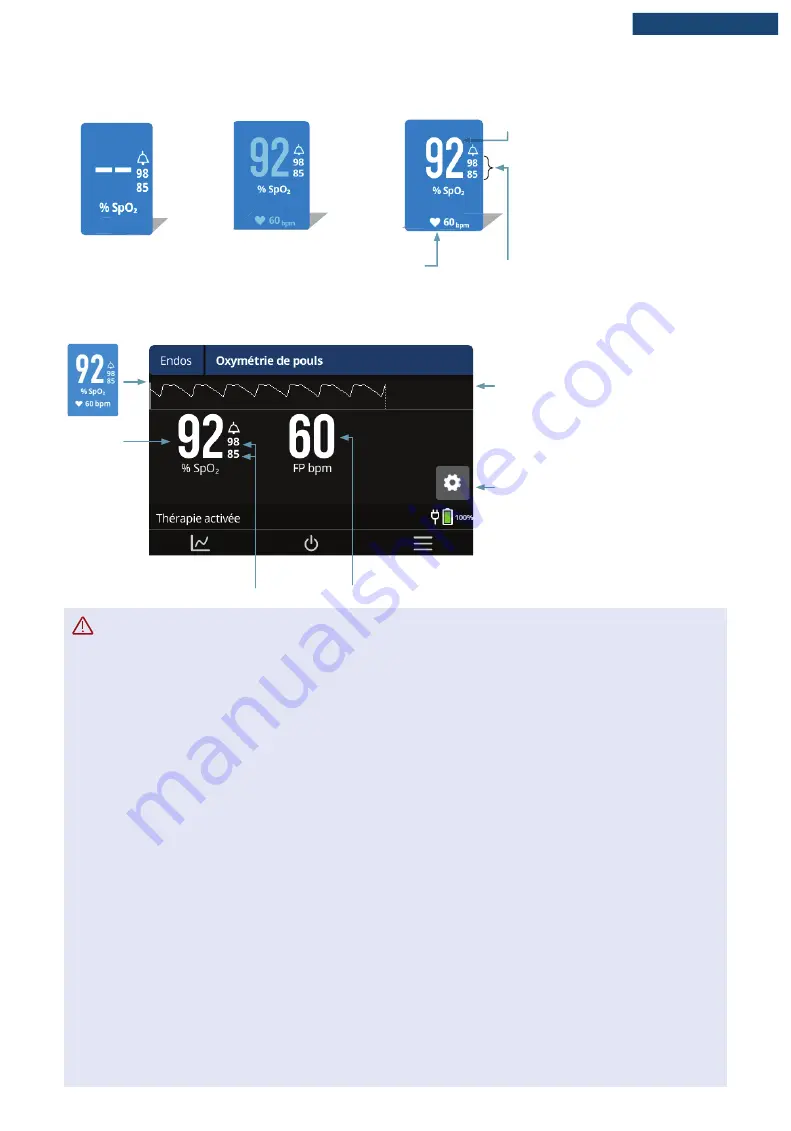 F&P Airvo 3 User Manual Download Page 200