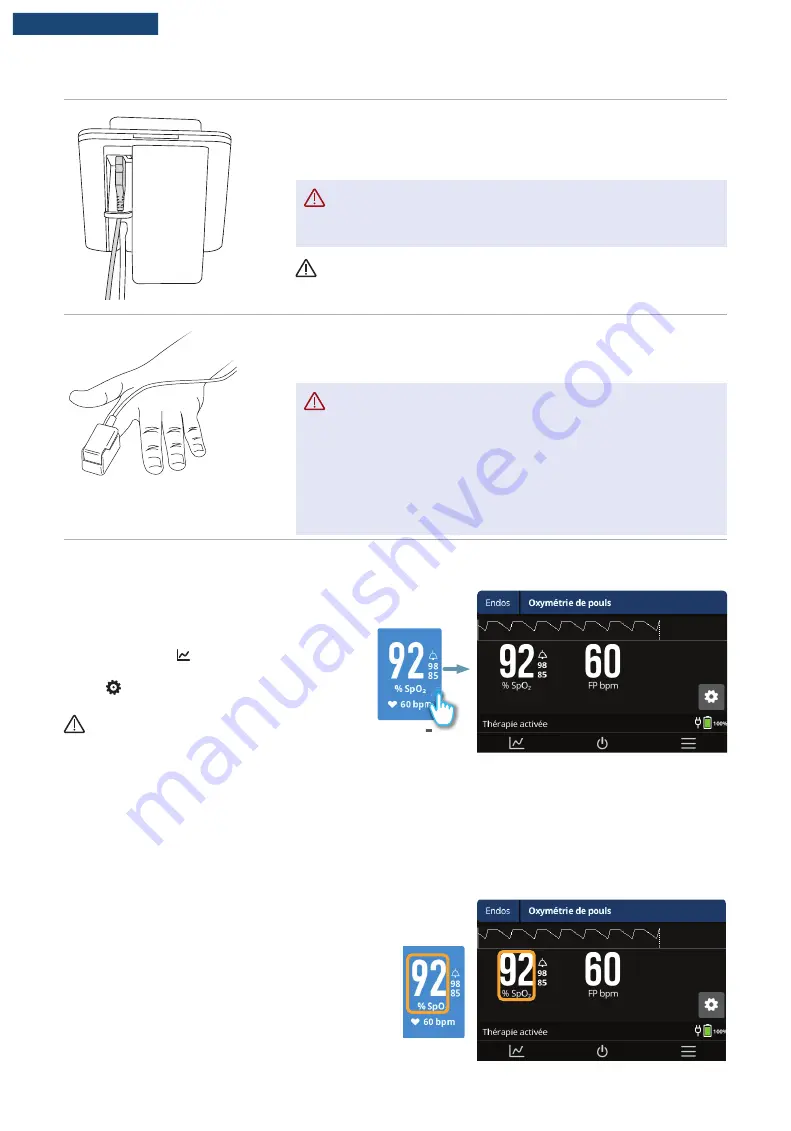 F&P Airvo 3 User Manual Download Page 201