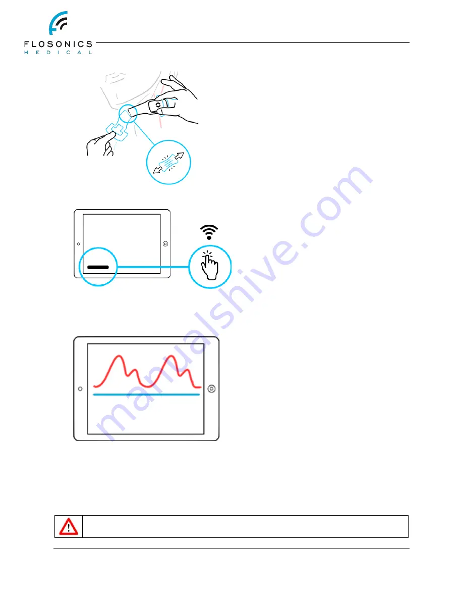 Flosonics Medical FloPatch FP120 User Manual Download Page 12