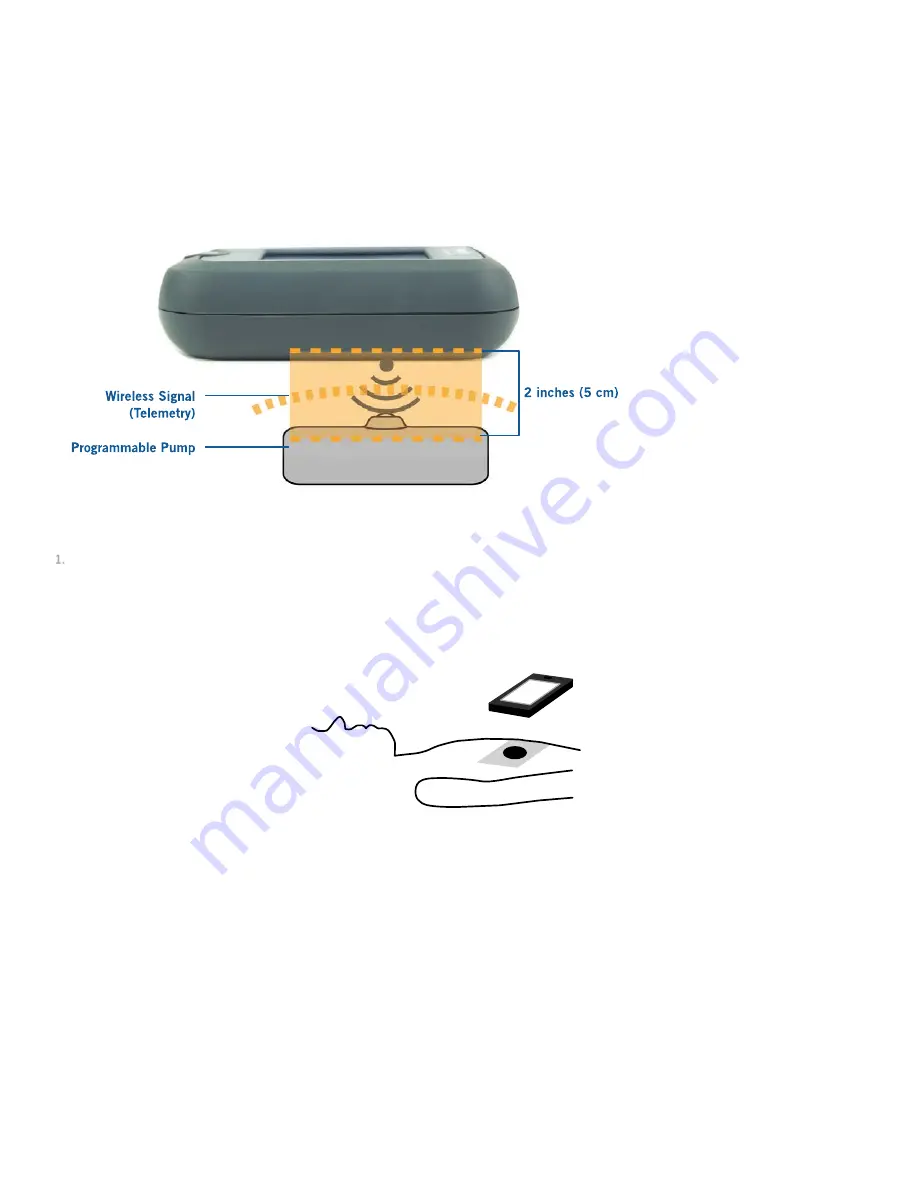 Flowonix Prometra Patient Therapy Controller Manual Download Page 9