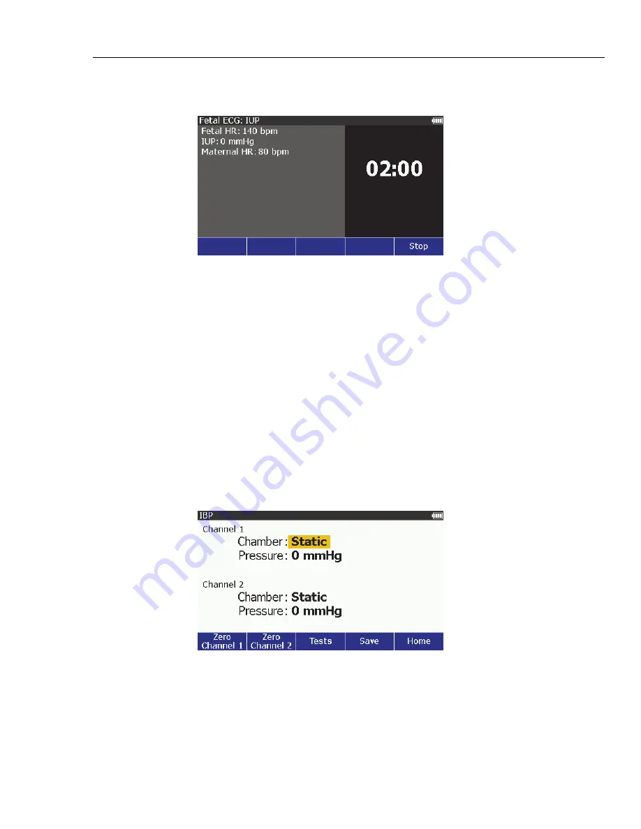 Fluke Biomedical ProSim 8 Series User Manual Download Page 43