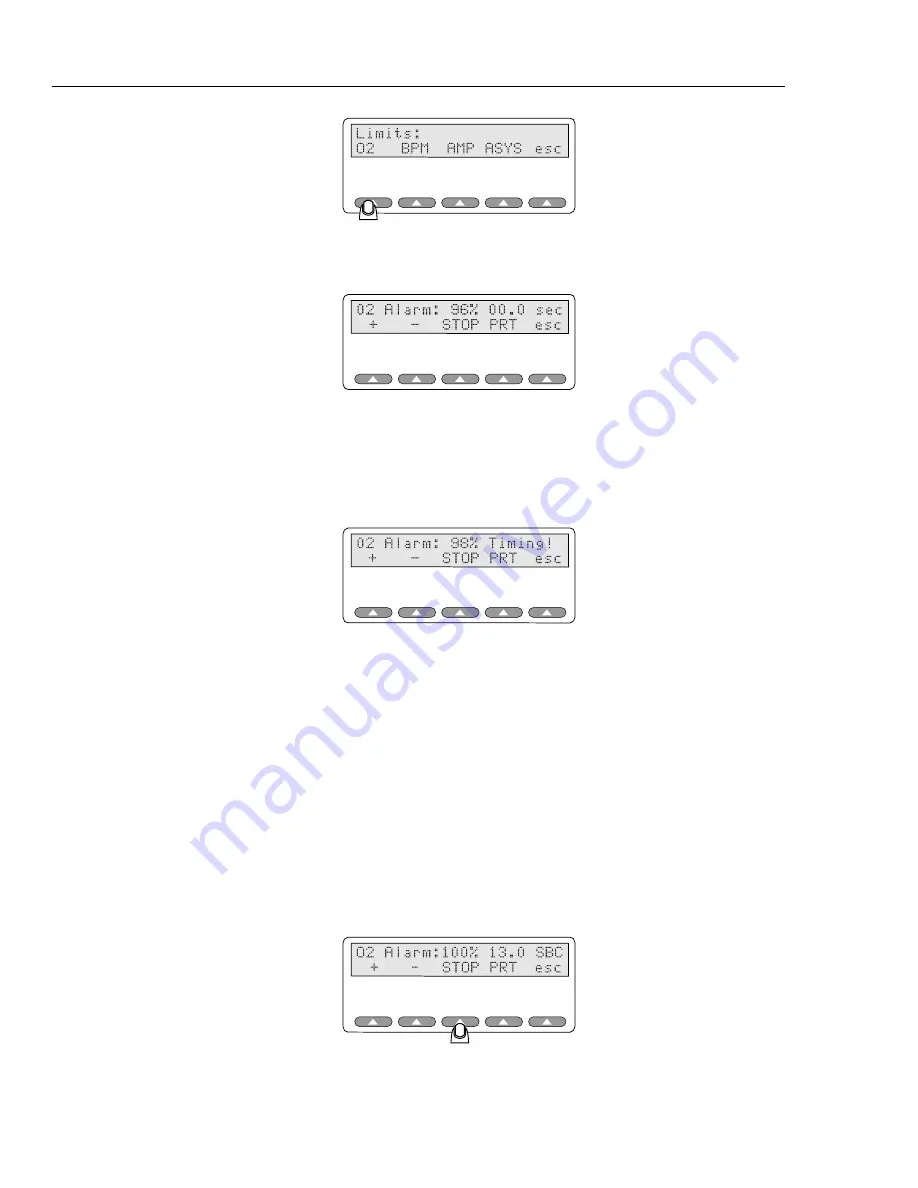 Fluke Biomedical Index 2MF User Manual Download Page 44