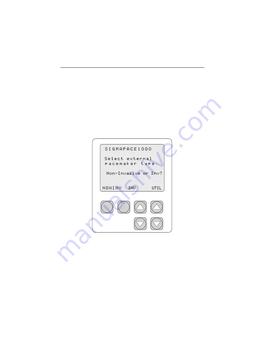 Fluke SigmaPace 1000 Operator'S Manual Download Page 64