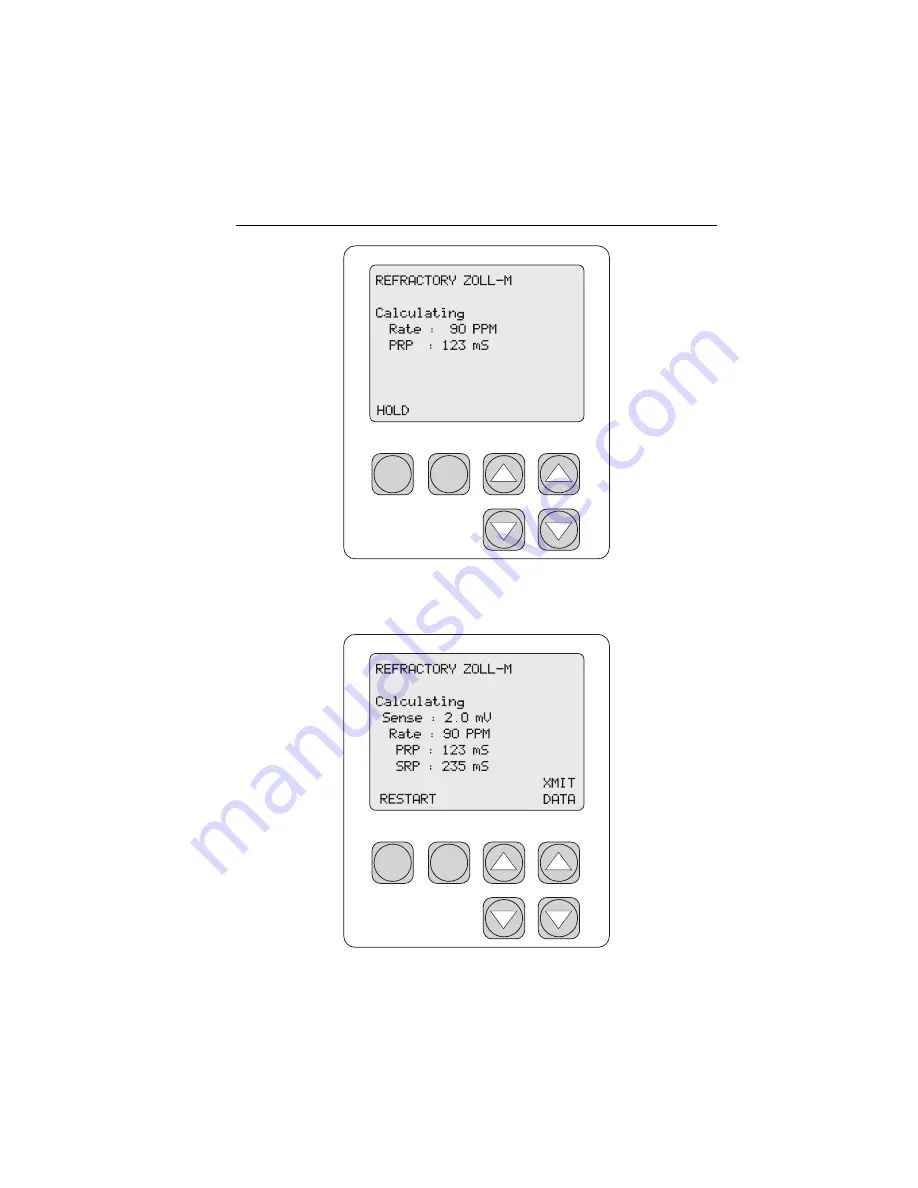 Fluke SigmaPace 1000 Operator'S Manual Download Page 73