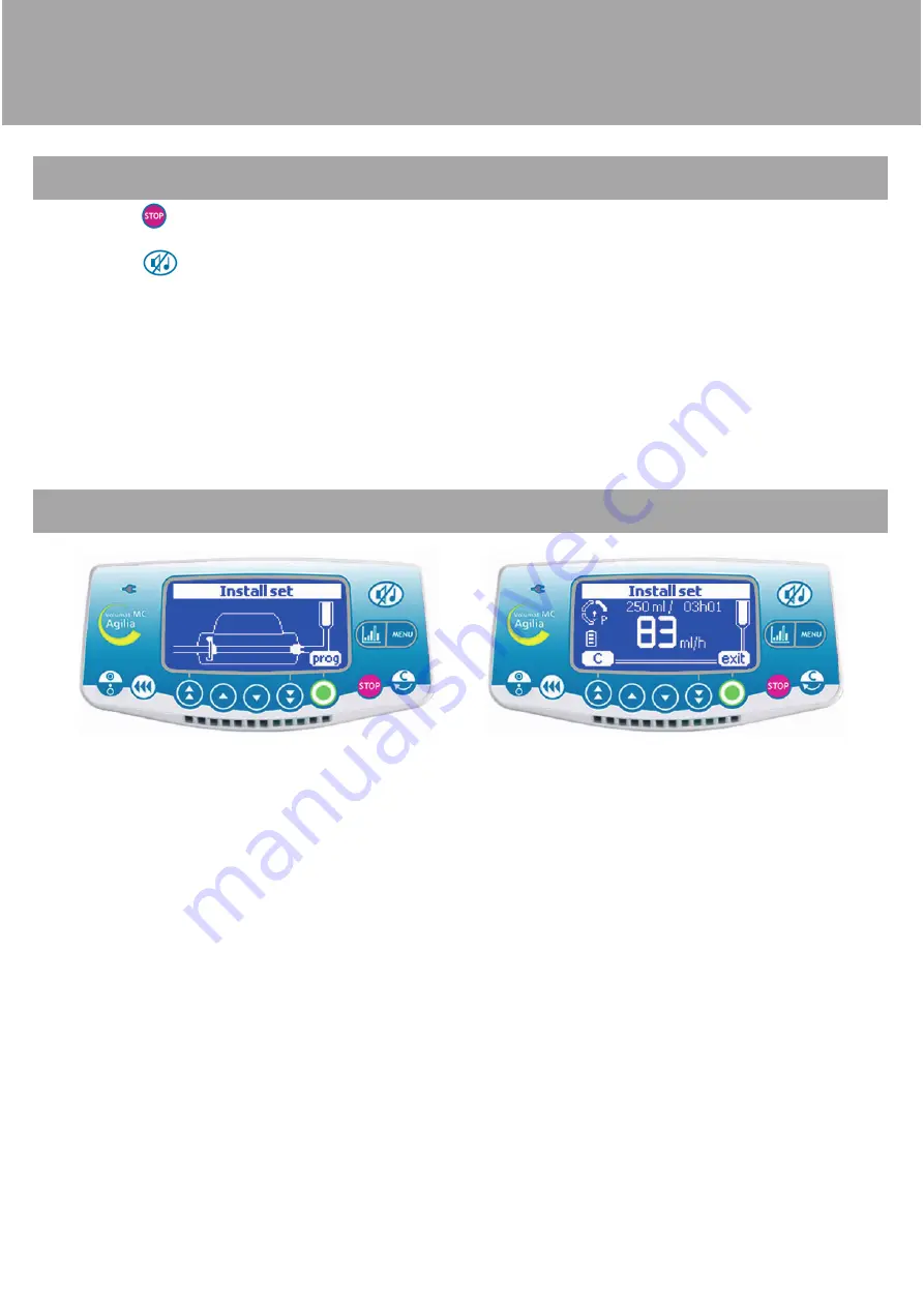 Fresenius Kabi Agilia Series Instructions For Use Manual Download Page 34