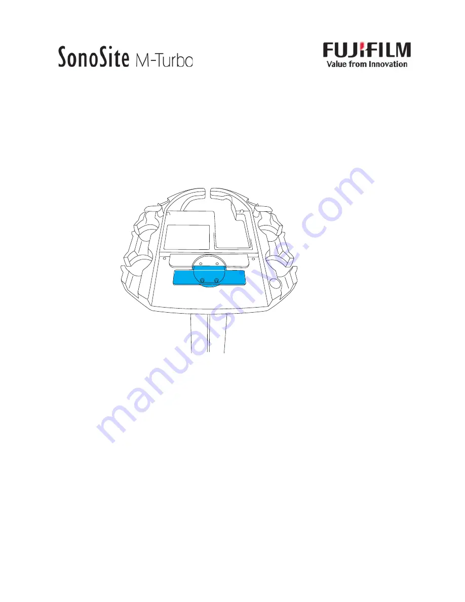 FujiFilm SonoSite M-Turbo Assembly Instructions Download Page 1