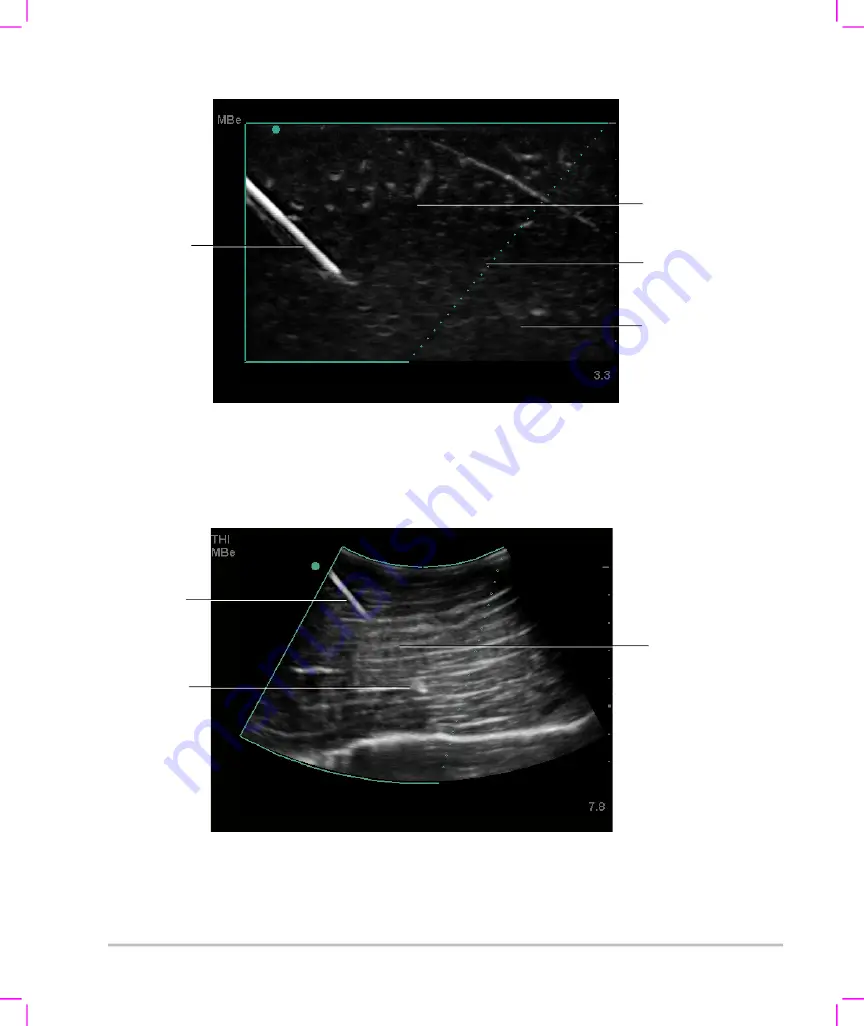 FujiFilm SonoSite S Series User Manual Supplement Download Page 104