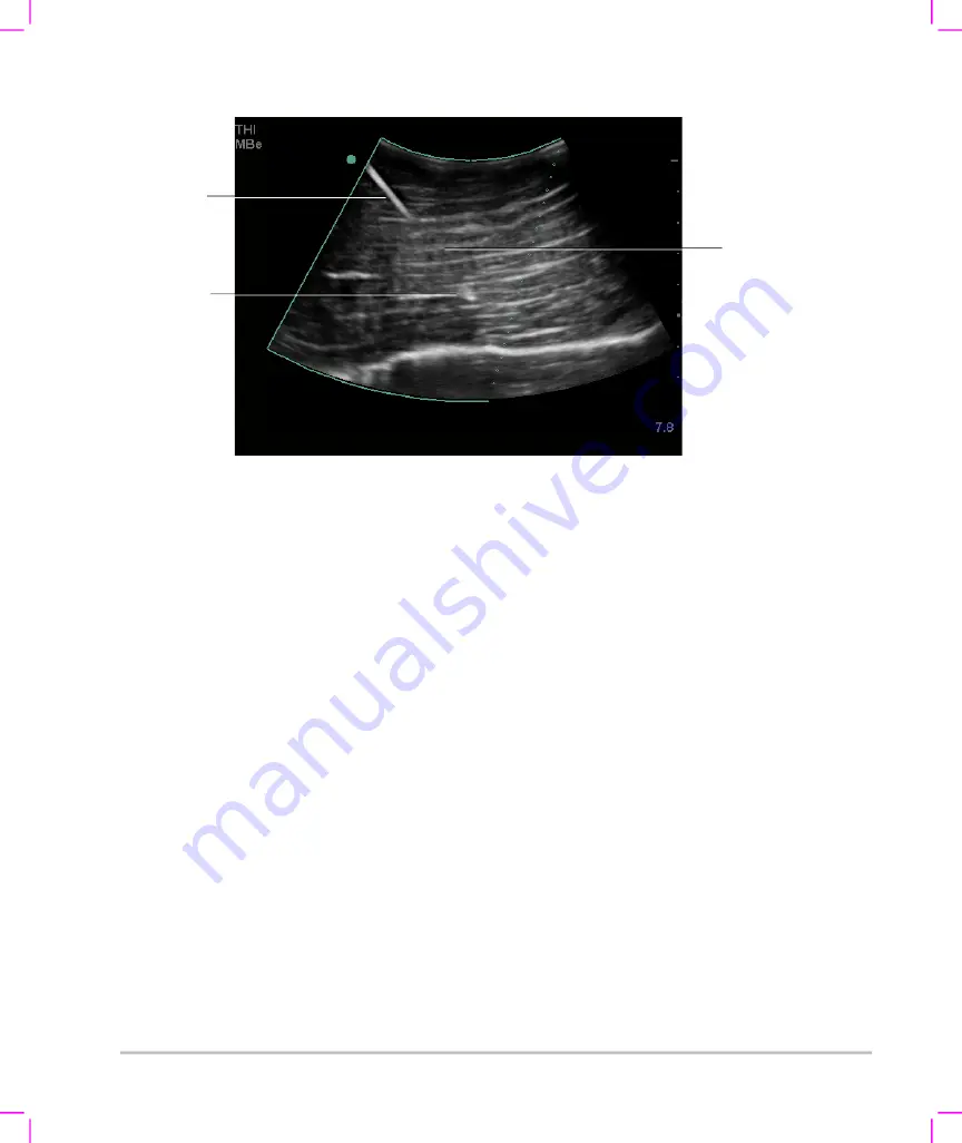 FujiFilm SonoSite S Series User Manual Supplement Download Page 116