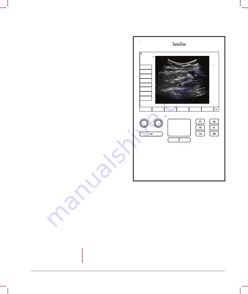 FujiFilm SonoSite SII User Manual Supplement Download Page 140