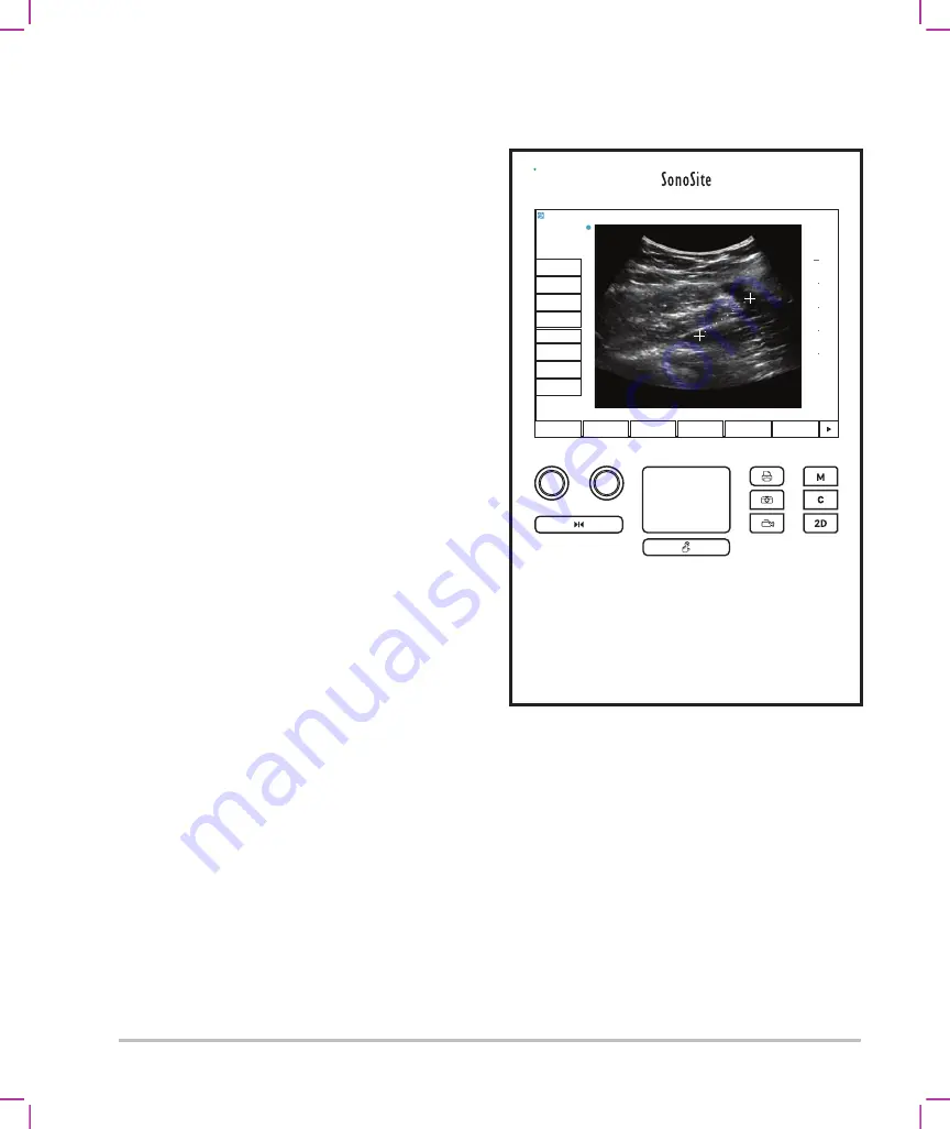 FujiFilm SonoSite SII User Manual Supplement Download Page 342