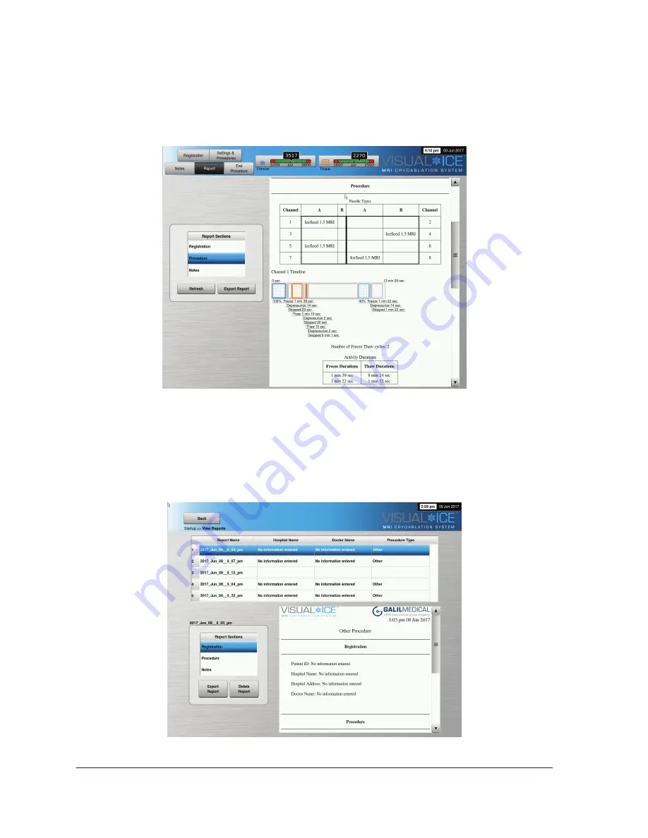 Galil Visual-ICE MRI User Manual Download Page 38