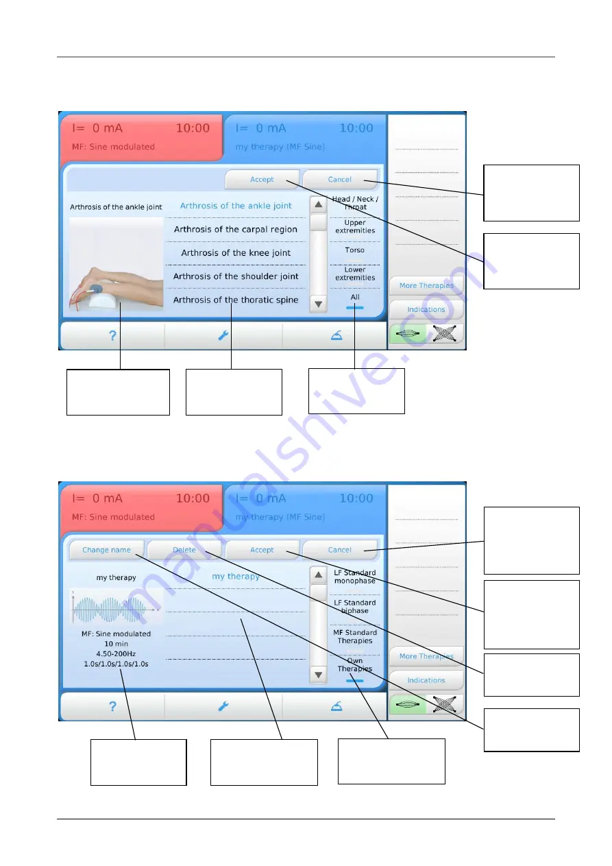 gbo Medizintechnik Duodynator Instructions For Use Manual Download Page 13