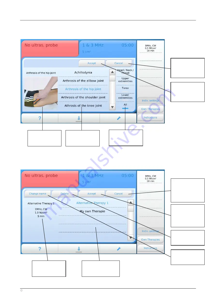 gbo Medizintechnik Sonostat User Manual Download Page 13