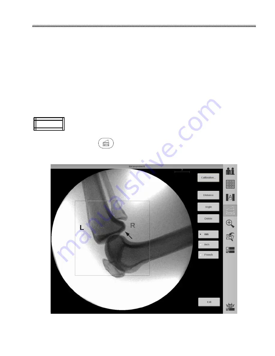 GE Brivo OEC 715 Operator'S Manual Download Page 114