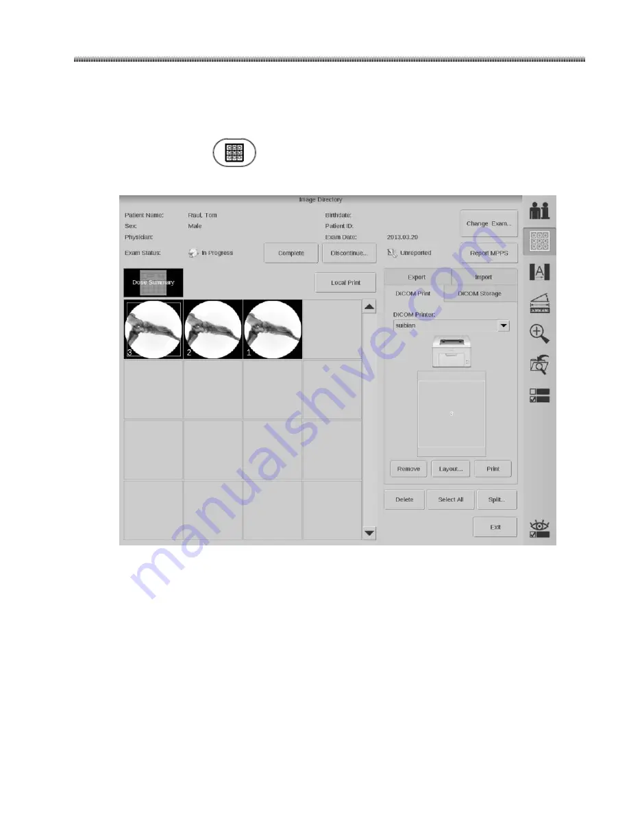 GE Brivo OEC 715 Operator'S Manual Download Page 134