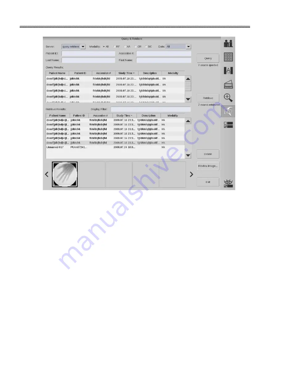 GE Brivo OEC 715 Operator'S Manual Download Page 137