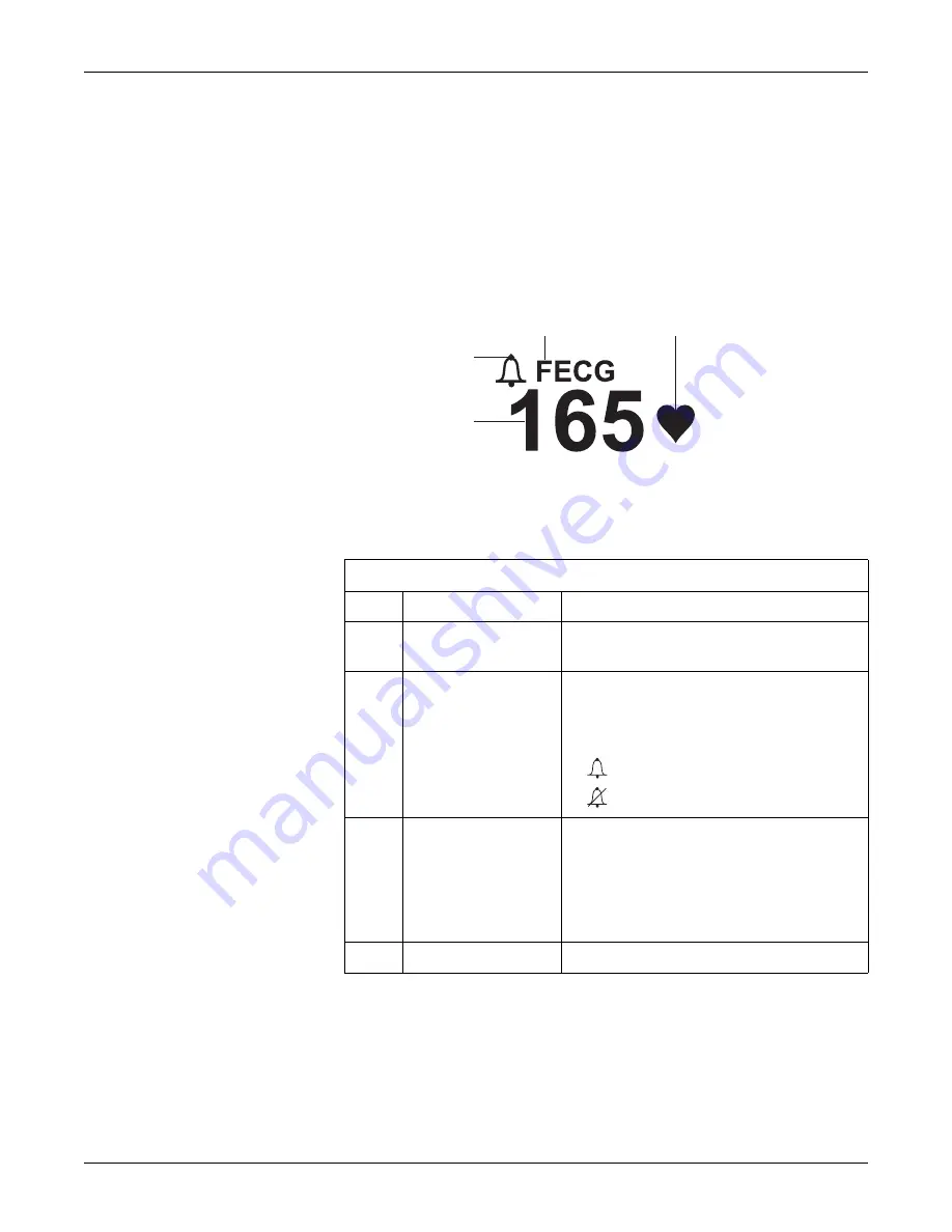 GE Corometrics 250cx Series Operator'S Manual Download Page 42