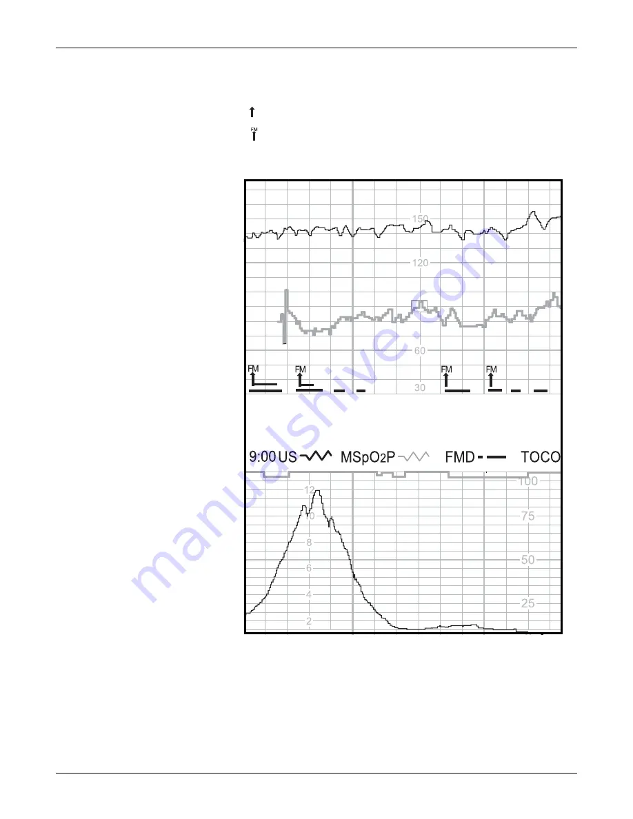 GE Corometrics 250cx Series Operator'S Manual Download Page 211