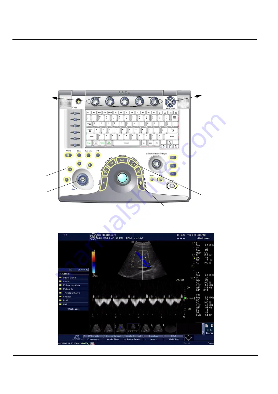 GE LOGIQ e R4 Series Скачать руководство пользователя страница 108