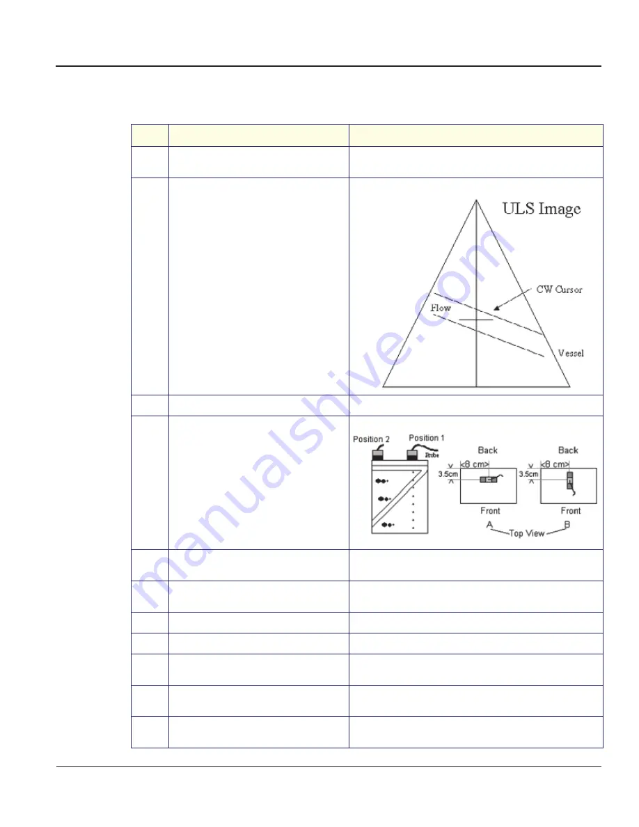 GE Vivid 3 Pro Service Manual Download Page 157