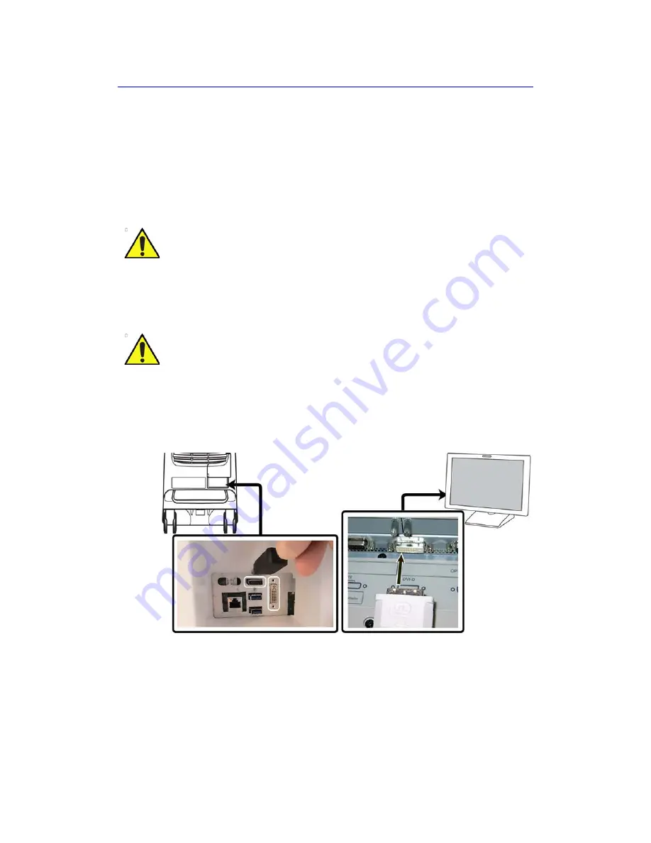 GE Vivid S70 Скачать руководство пользователя страница 679