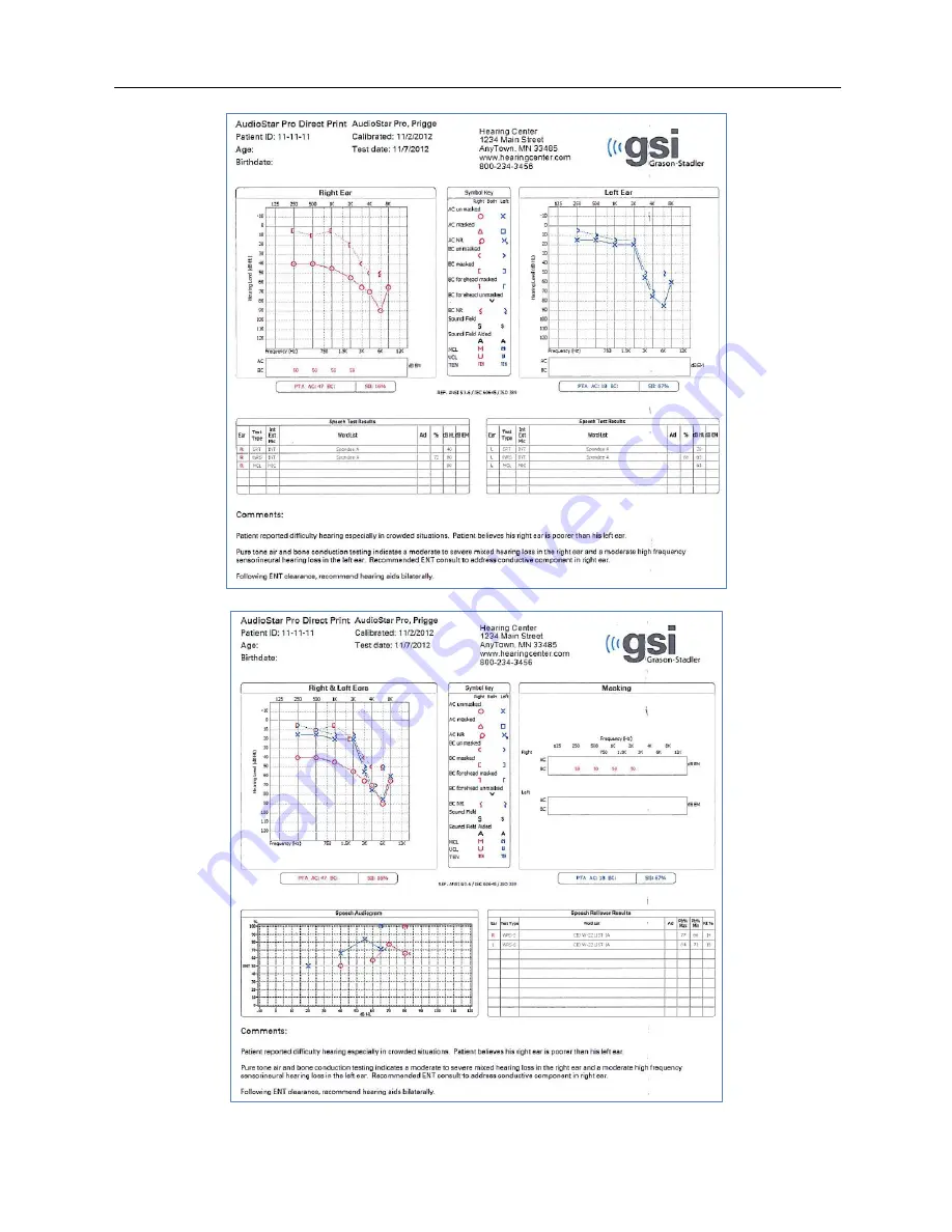 GSi AUDIOSTAR PRO Скачать руководство пользователя страница 35