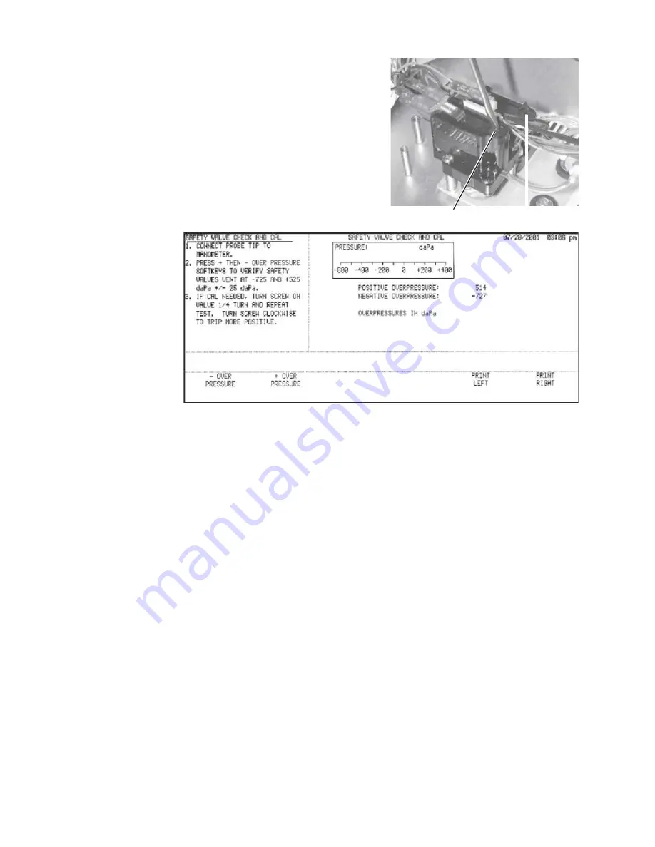 GSi TYMPSTAR 1 Service Manual Download Page 120