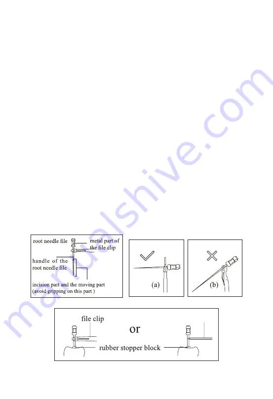 Guilin Woodpecker Medical Instrument Endo Radar Pro Скачать руководство пользователя страница 24