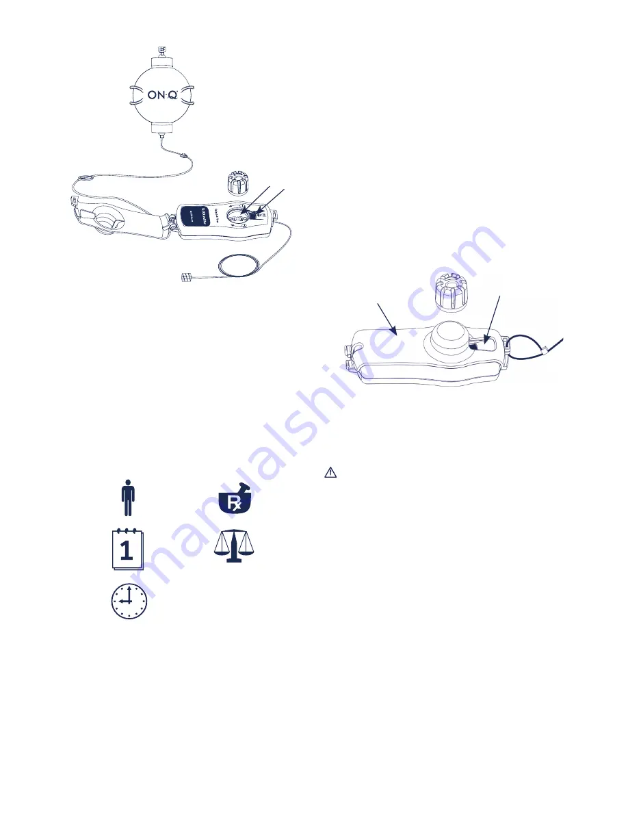 Halyard ON-Q Select-A-Flow Instructions For Use Manual Download Page 96