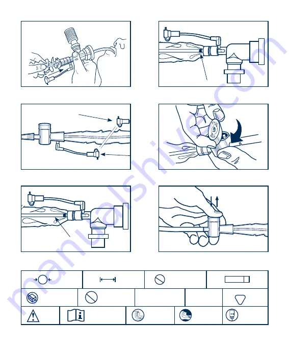 Halyard Turbo-Cleaning Closed Suction System for Adults with BALLARD... Скачать руководство пользователя страница 2